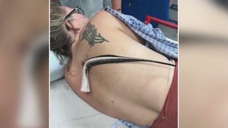 Florida woman impaled by stingray's tail