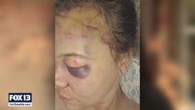 Fourth suspect arrested in Renton hate crime attack