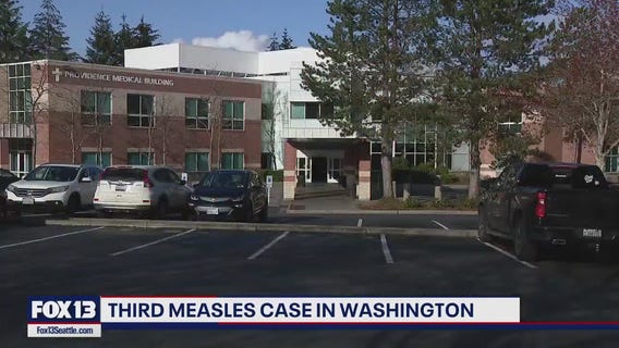 Third measles case confirmed in Washington