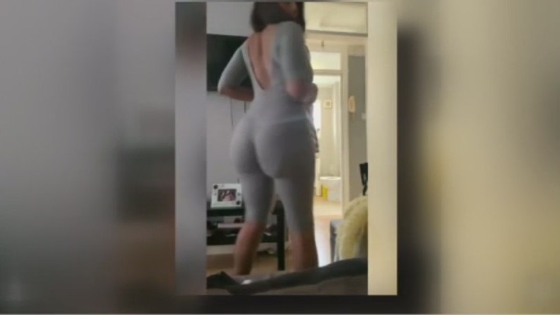 'I wish I'd never done it': Woman expresses regret years after getting a BBL