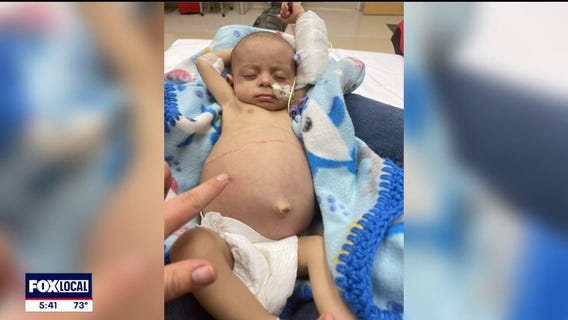 Texas baby recovering after complex liver transplant