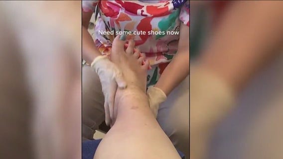 Woman with world's largest feet finally has shoes that fit thanks to custom shoe shop