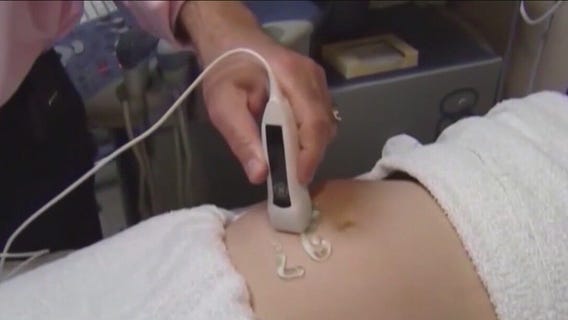 Indiana's high court weighing challenge to state abortion ban