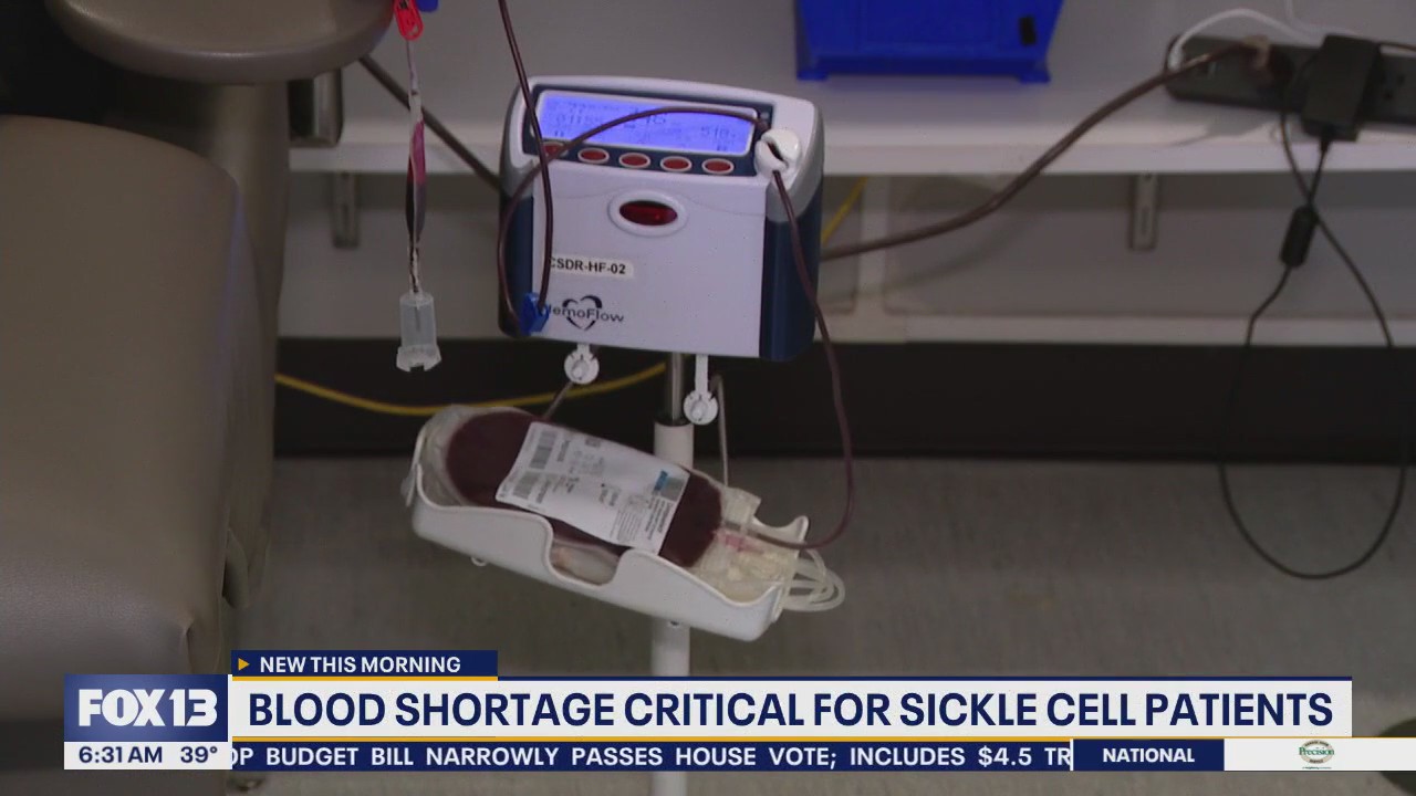 Blood shortage critical for sickle cell patients