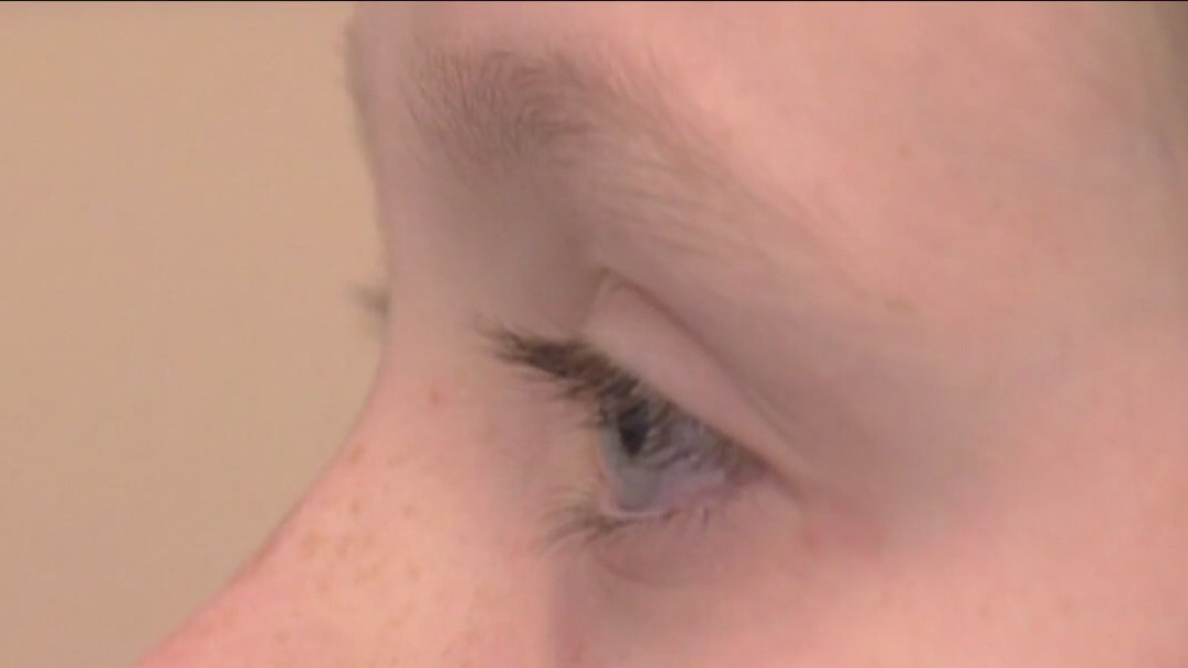 Eye drop alternatives for relief