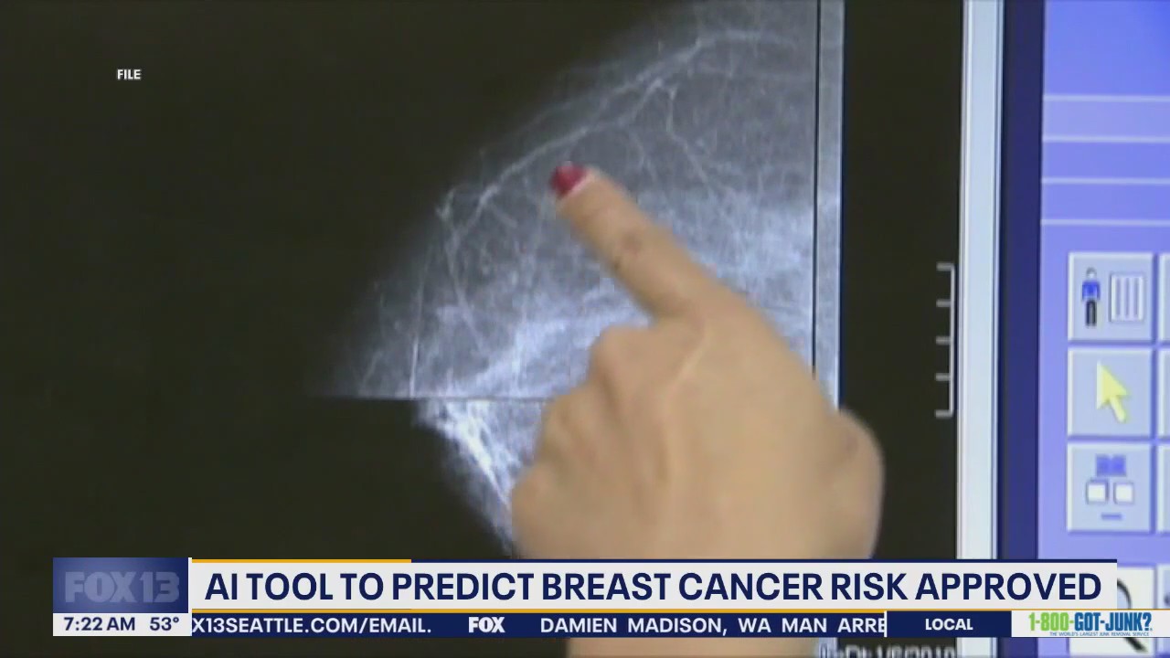 AI tool to predict breast cancer risk approved by FDA