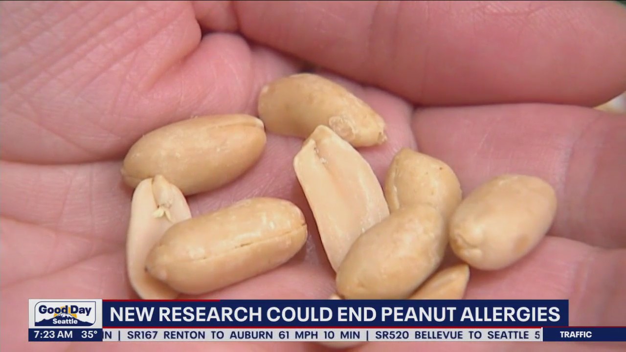 New research could end peanut allergies
