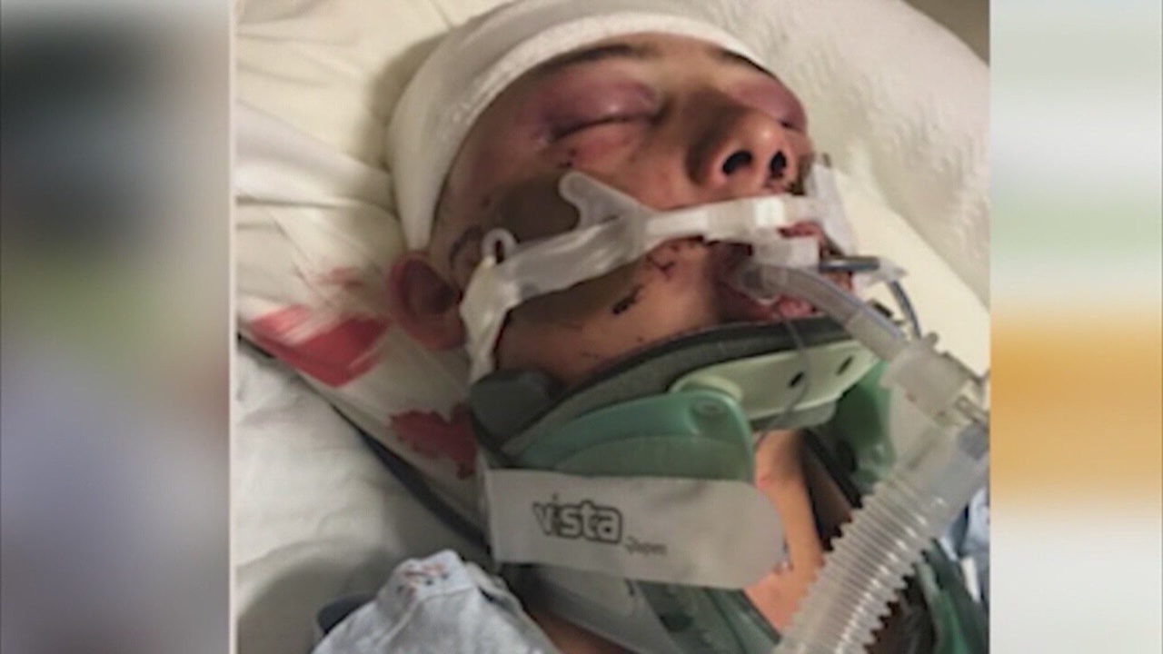 Police: San Pedro Teen Was Victim Of Brutal Gang Initiation