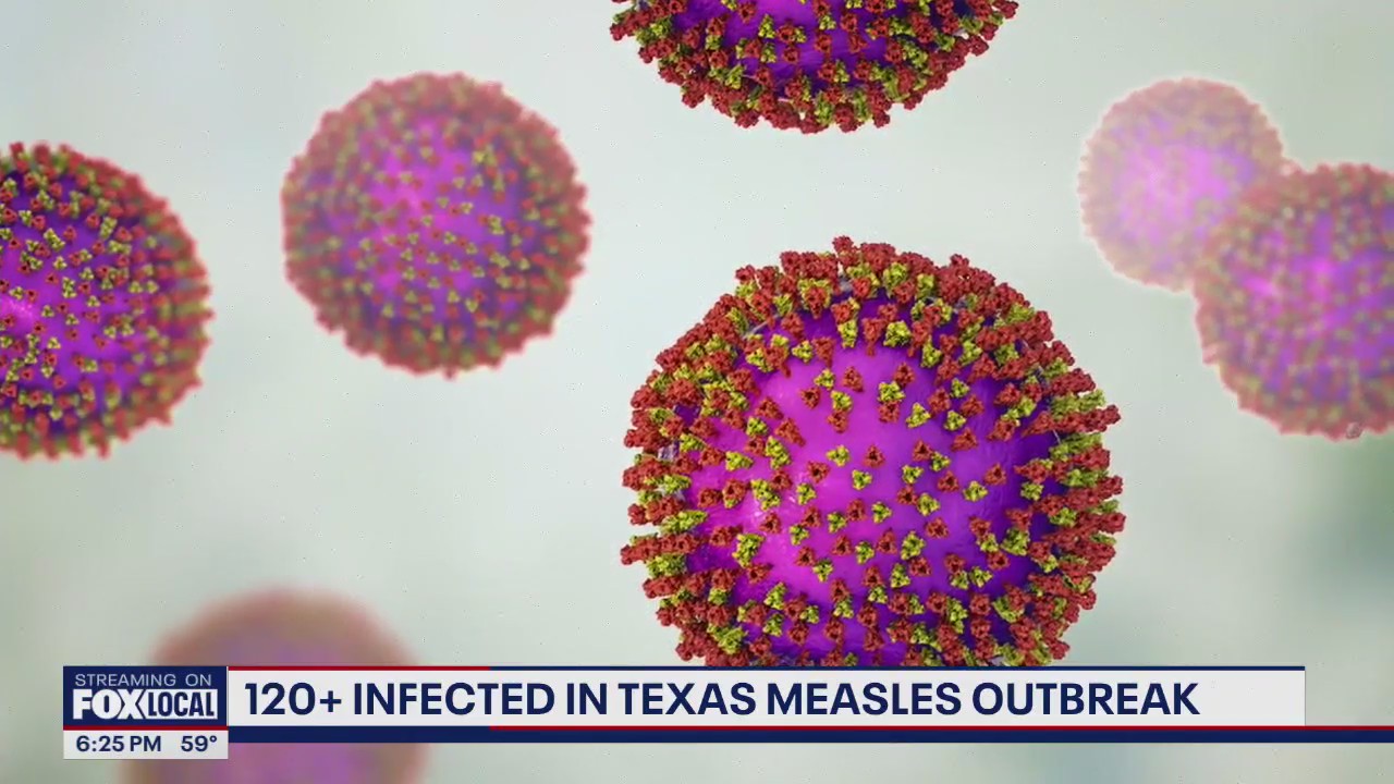 120+ infected in Texas measles outbreak | FOX 13 Seattle