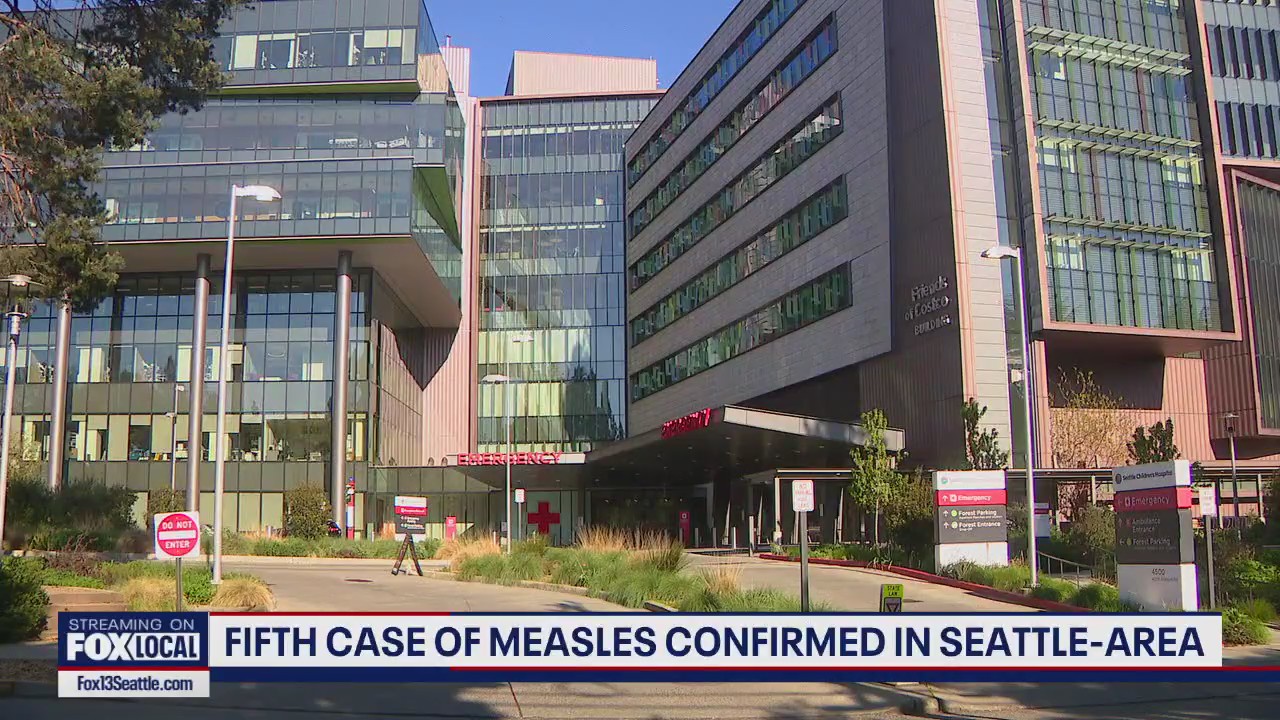 5th case of measles confirmed in Seattle area