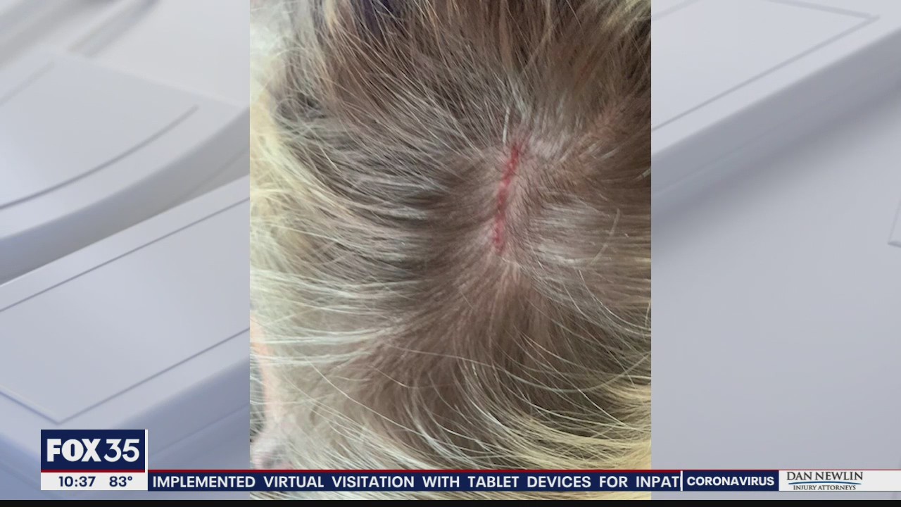 Aggressive hawks attack people during nesting season