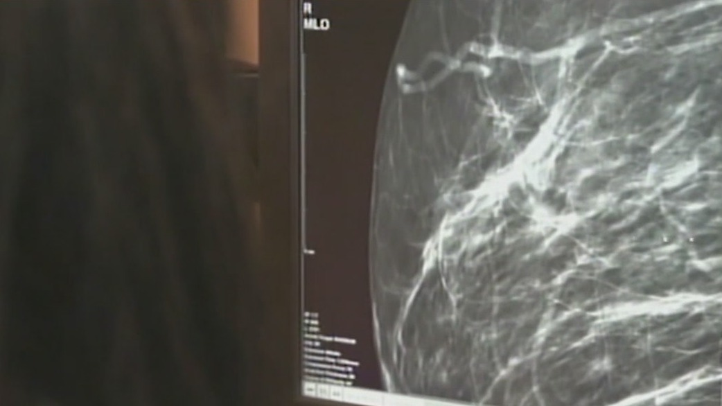 Medical advancements being made in breast cancer treatment and recovery