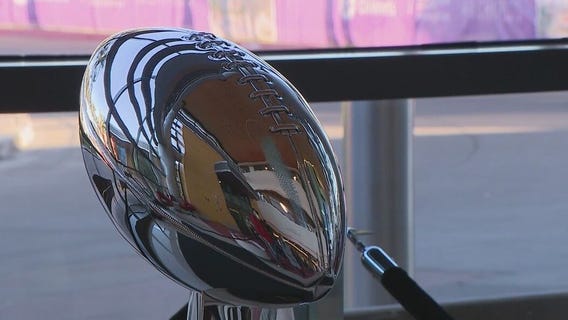 Vince Lombardi Trophy on display at Phoenix Children's Hospital after earning special award