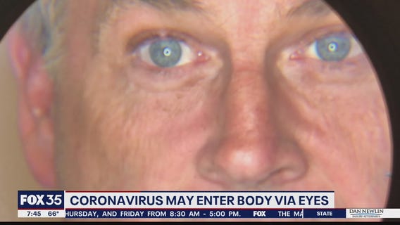 Search for Solutions: Coronavirus may enter through eyes