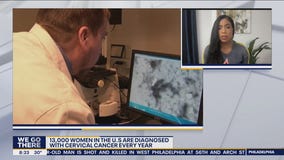 January is National Cervical Cancer Awareness month