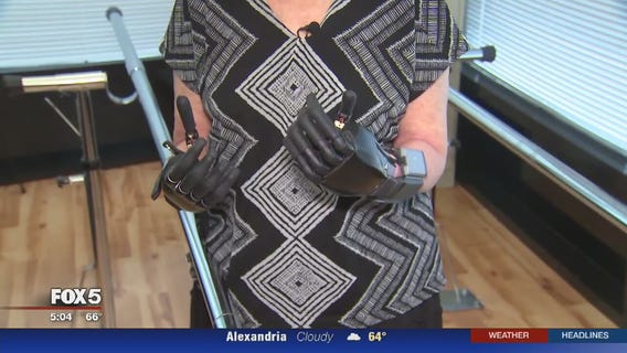 Quadruple amputee receives new prosthetic hands