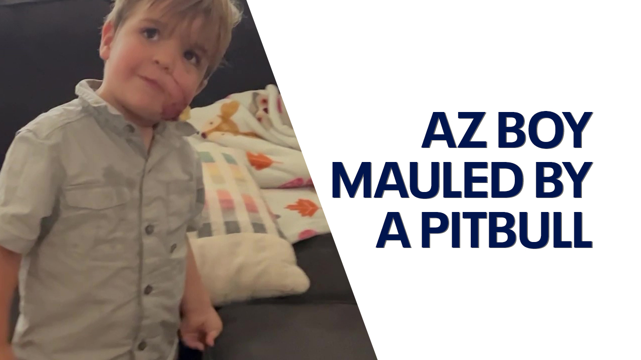 AZ mom speaks after pitbull mauls her son