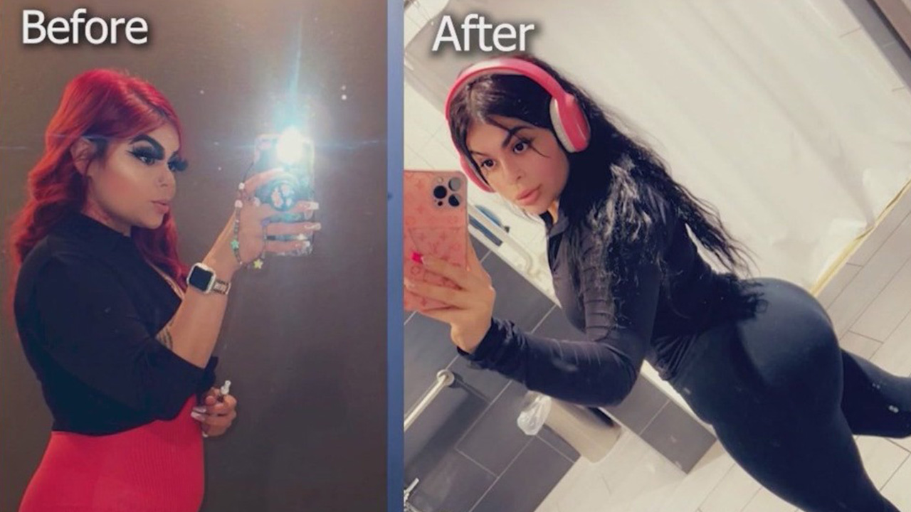 Woman nearly dies after getting plastic surgery in Mexico