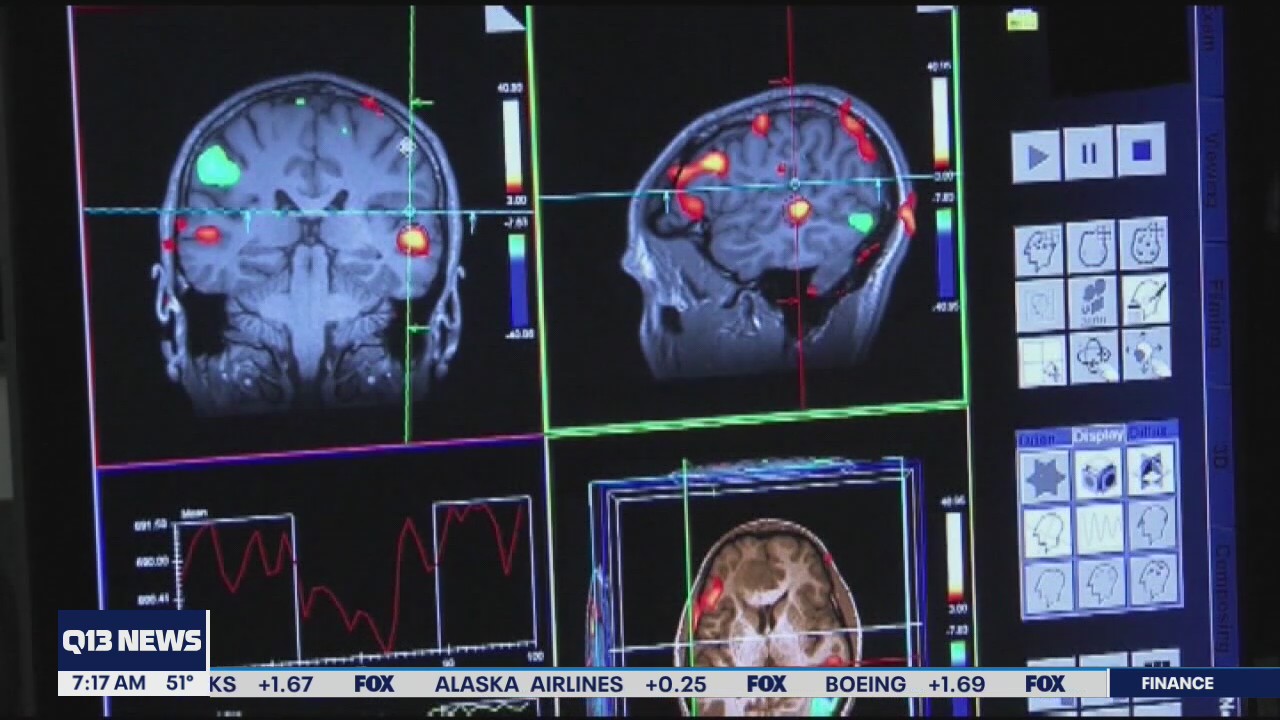 World Alzheimer's Day: Understanding memory loss