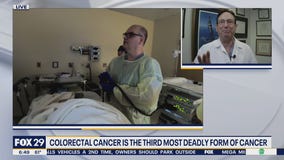 New guidance recommends getting examined for colorectal cancer at age 45