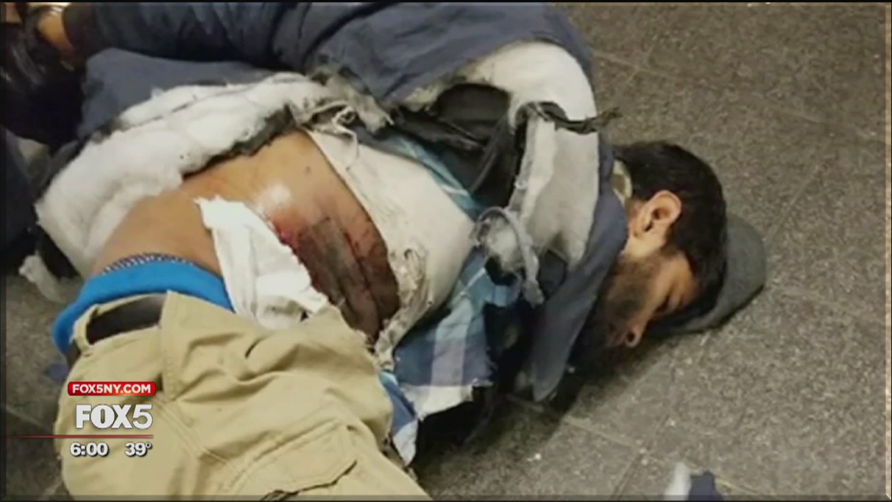 Pipe bomb blast probe