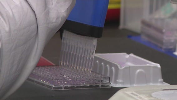 Parkinson?s Disease: New test to diagnose illness