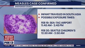 Measles confirmed in Snohomish County