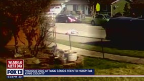 Woman in critical condition after dog attack, neighbors step in to help