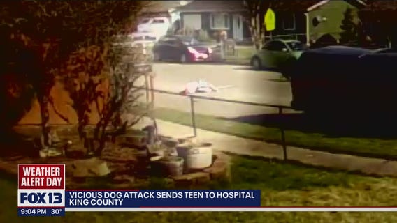 Woman in critical condition after dog attack, neighbors step in to help