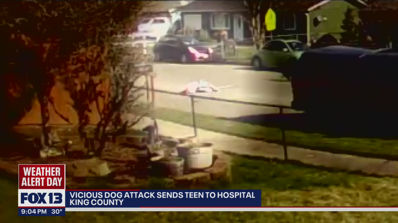 Woman in critical condition after dog attack, neighbors step in to help