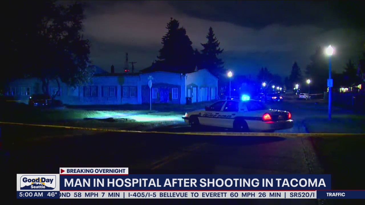 Man hospitalized after Tacoma shooting