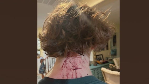 3 alleged 'Gilbert Goons' take plea deals