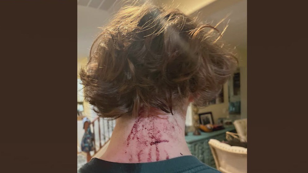 3 alleged 'Gilbert Goons' take plea deals