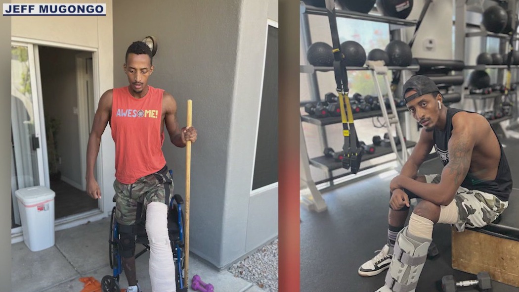 Motorcycle crash survivor shares story for awareness