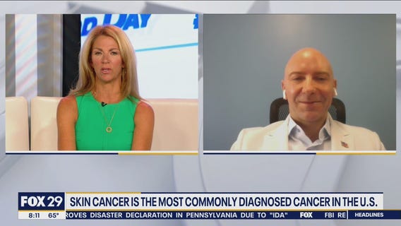 Skin cancer is the most commonly diagnosed cancer in the US