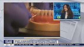 How brushing your teeth can impact Alzheimer's risk