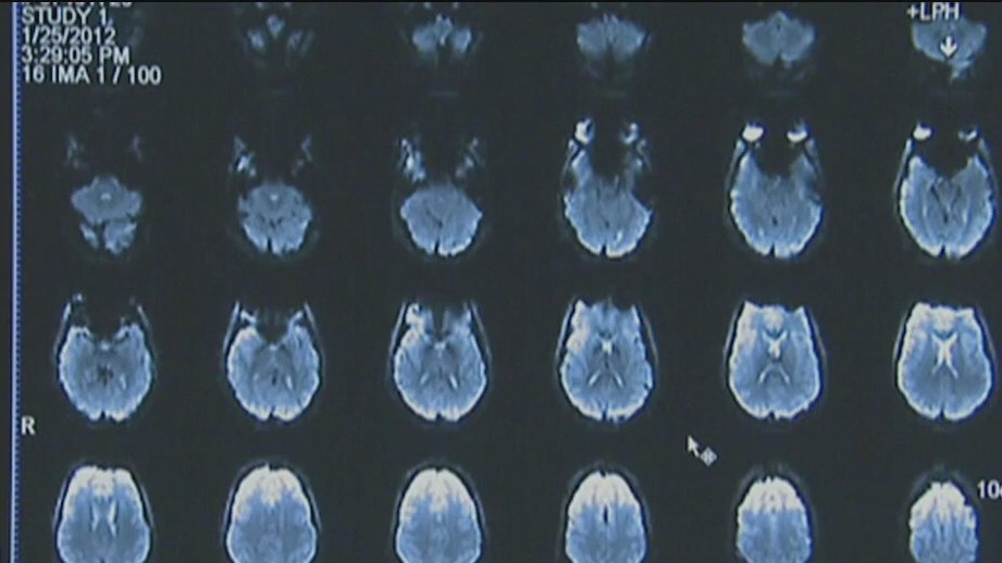 Alzheimer's Awareness Month