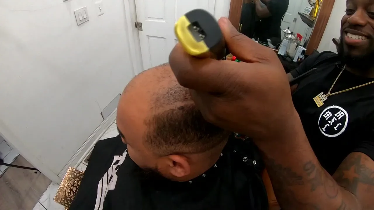 The Hairline You Deserve