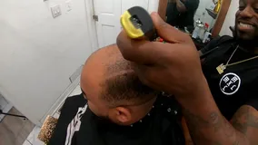 The Hairline You Deserve
