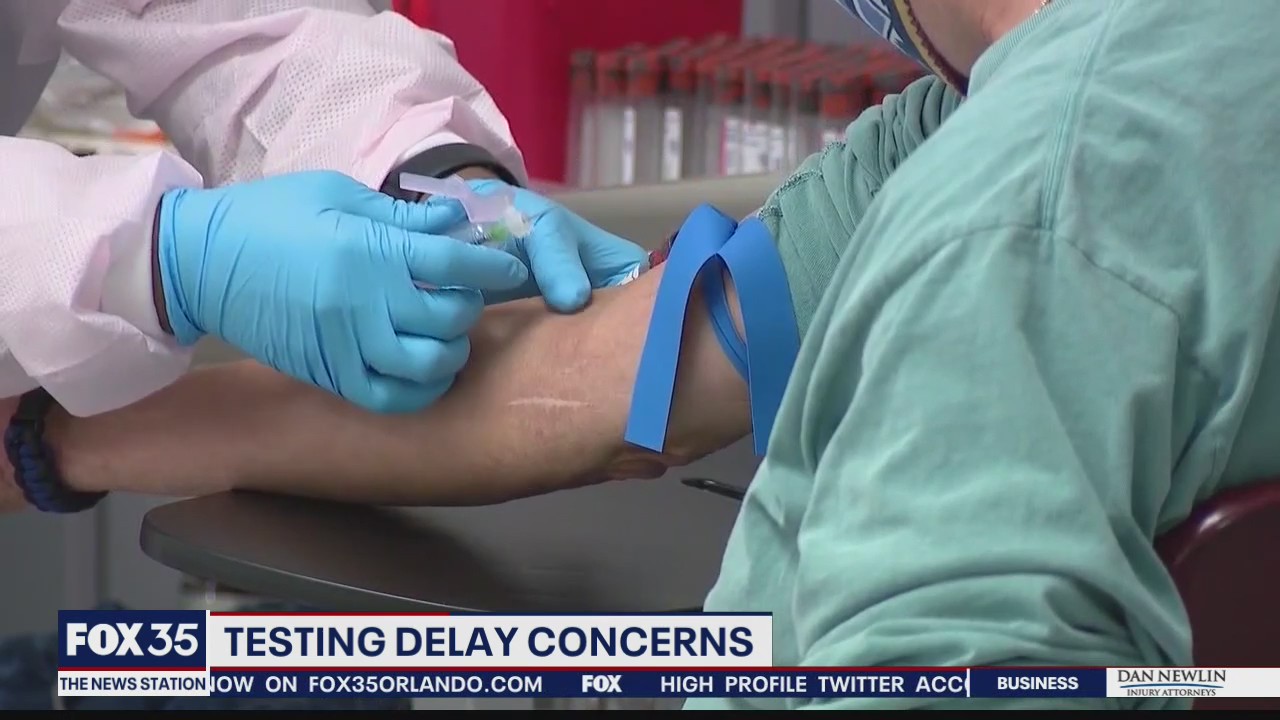 COVID-19 testing delay concerns