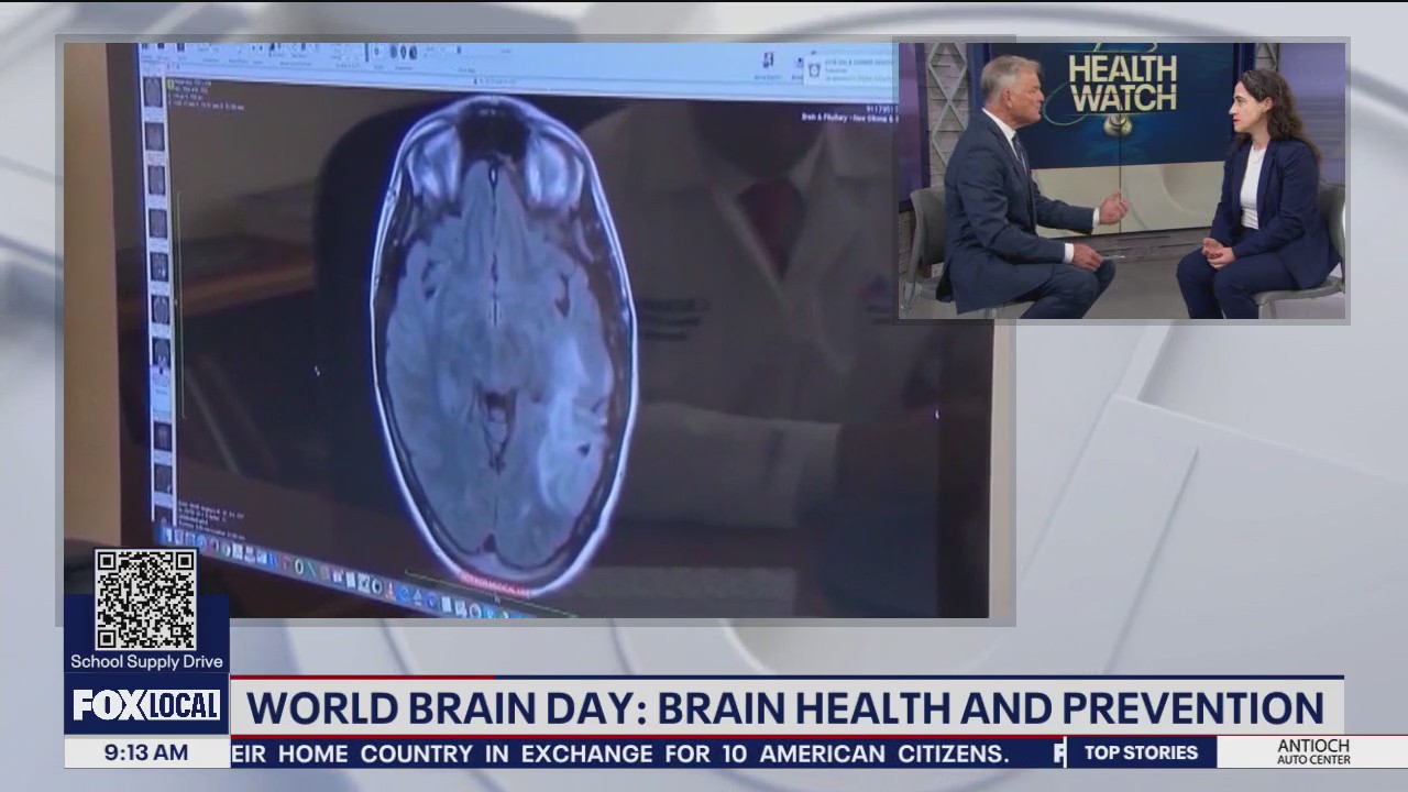 Staying on top of brain health ahead of World Brain Day