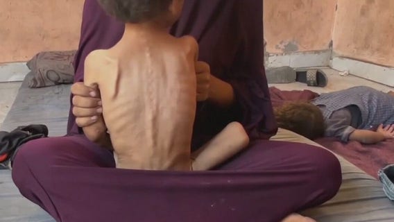 Berkeley organization trying to send aid to Gaza, as mass starvation causes death