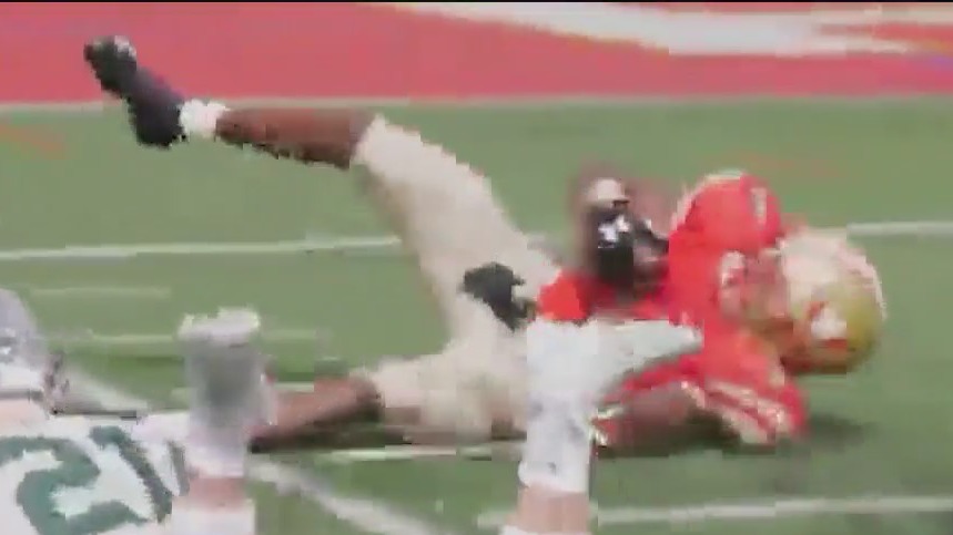 New tool transforming how doctors treat joint pain without surgery