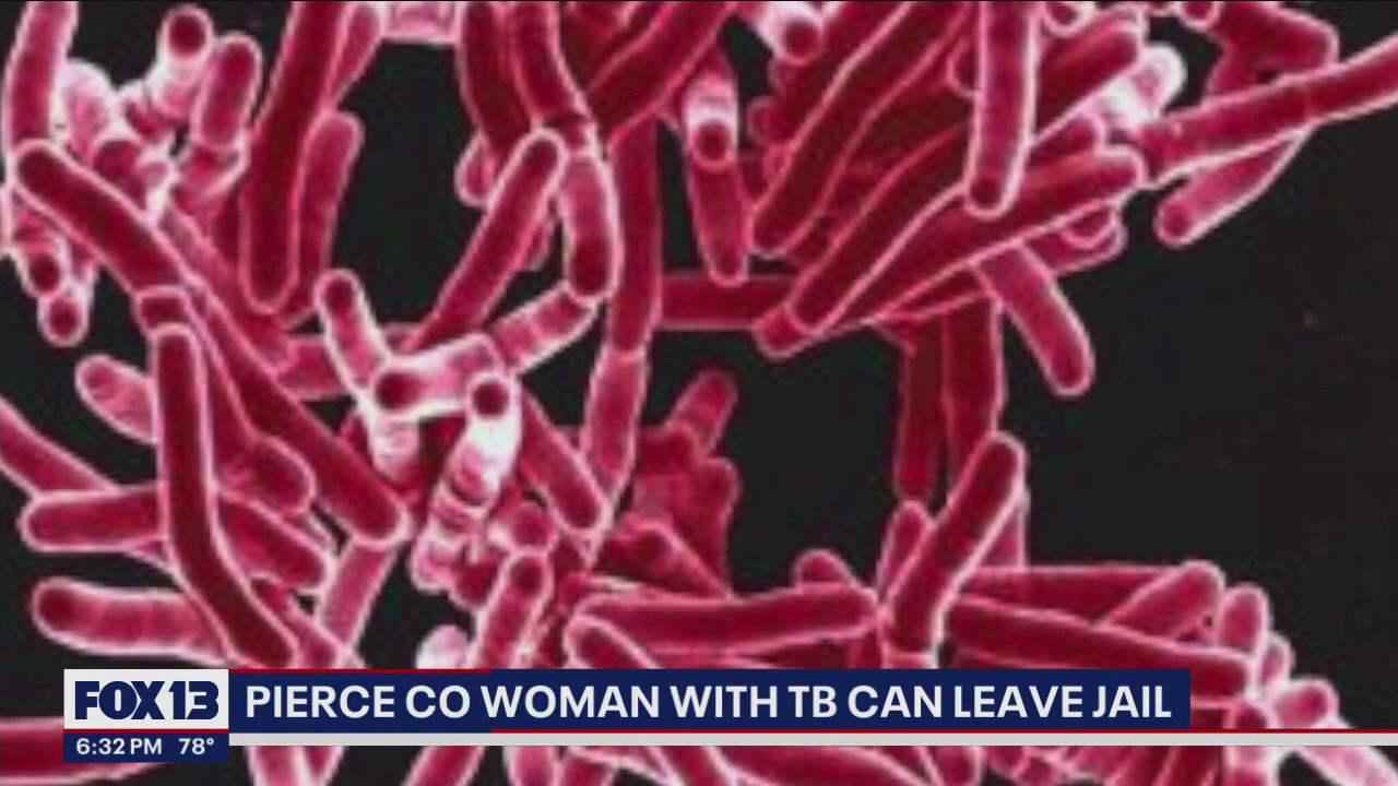 Judge rules woman with tuberculosis can leave jail