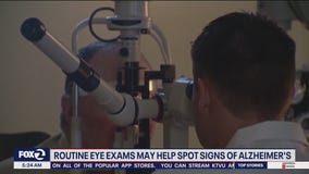 Routine eye exams can detect serious health issues