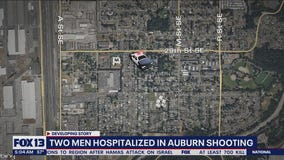 Auburn shooting leaves 2 men hospitalized