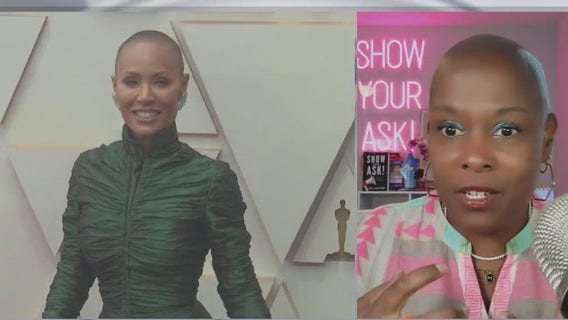 Alopecia at work: why being yourself matters