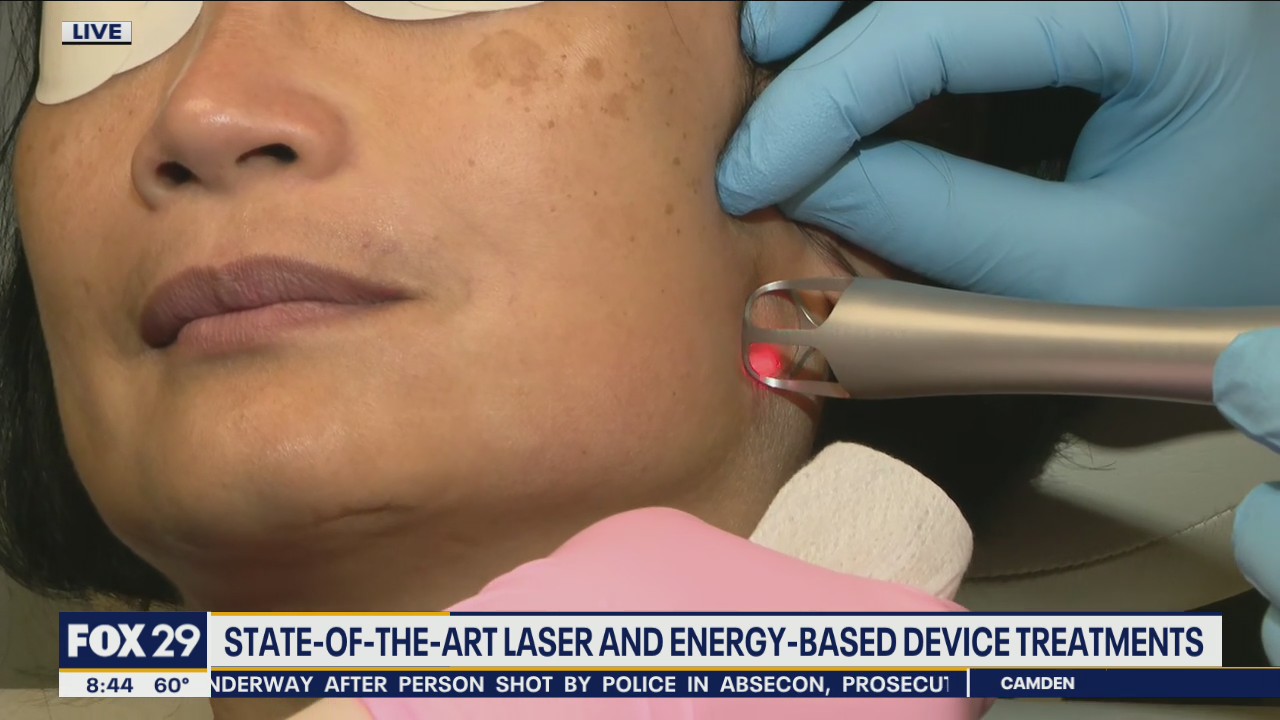 Local doctors invents laser system to help women of color