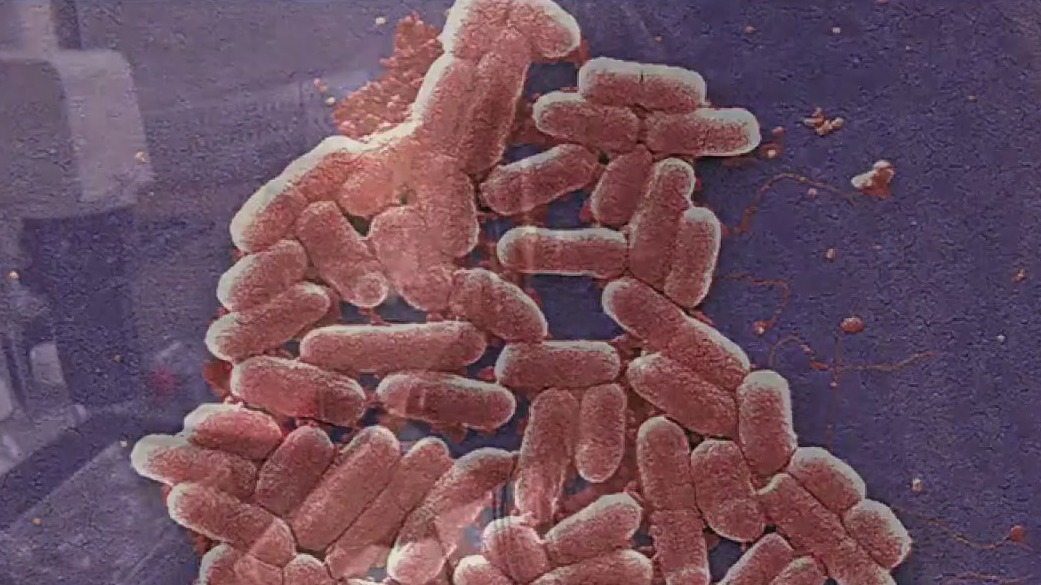 Antibiotic-resistant 'superbugs' surge is spreading, WHO says