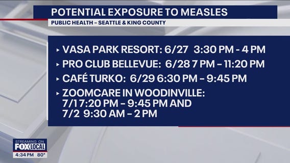 Possible measles exposure in Bellevue, Seattle, Woodinville